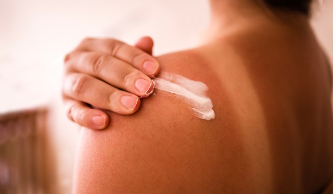 Abbronzatura perfetta: perché alcune persone si scottano subito e altre no?