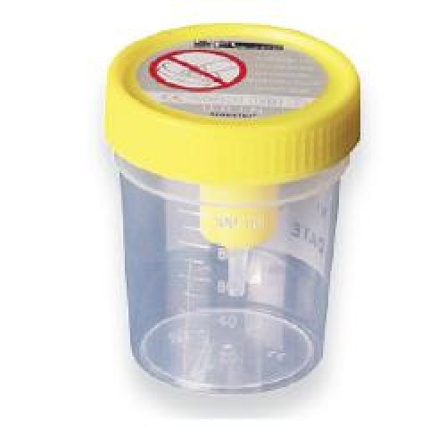 MEDIPRESTERIL contenitore urina sterile con provetta